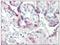 Cyclin Dependent Kinase 2 antibody, AM08409PU-N, Origene, Immunohistochemistry frozen image 