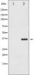 NFKB Inhibitor Epsilon antibody, TA325735, Origene, Western Blot image 