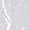 3-Hydroxybutyrate Dehydrogenase 2 antibody, HPA036029, Atlas Antibodies, Immunohistochemistry paraffin image 