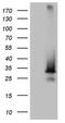 Sorting Nexin 10 antibody, NBP2-45894, Novus Biologicals, Western Blot image 