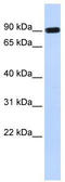 HECT Domain E3 Ubiquitin Protein Ligase 2 antibody, TA331540, Origene, Western Blot image 