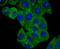 BLCAP Apoptosis Inducing Factor antibody, NBP2-75420, Novus Biologicals, Immunocytochemistry image 