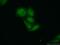 Syndecan Binding Protein antibody, 22399-1-AP, Proteintech Group, Immunofluorescence image 