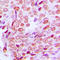 Prefoldin Subunit 1 antibody, LS-C356246, Lifespan Biosciences, Immunohistochemistry frozen image 