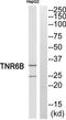 TNF Receptor Superfamily Member 6b antibody, TA314807, Origene, Western Blot image 