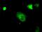 cGMP-dependent protein kinase 1 antibody, MA5-25110, Invitrogen Antibodies, Immunocytochemistry image 