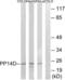 Protein phosphatase 1 regulatory subunit 14D antibody, LS-C120260, Lifespan Biosciences, Western Blot image 