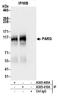 Poly(ADP-ribose) glycohydrolase antibody, A305-405A, Bethyl Labs, Immunoprecipitation image 