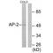 Transcription Factor AP-2 Alpha antibody, A01167-1, Boster Biological Technology, Western Blot image 