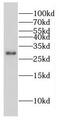 CPX Chromosome Region Candidate 1 antibody, FNab01948, FineTest, Western Blot image 