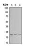 ATP Synthase Peripheral Stalk Subunit D antibody, orb393216, Biorbyt, Western Blot image 