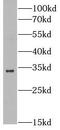 Homeobox protein MSX-1 antibody, FNab09991, FineTest, Western Blot image 