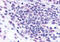 C-C Motif Chemokine Receptor 3 antibody, MBS244931, MyBioSource, Immunohistochemistry paraffin image 