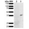 Metallothionein antibody, LS-C774676, Lifespan Biosciences, Western Blot image 