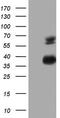Mesothelin antibody, TA805169, Origene, Western Blot image 