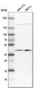 DnaJ Heat Shock Protein Family (Hsp40) Member B11 antibody, HPA010814, Atlas Antibodies, Western Blot image 
