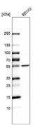 Lysophosphatidylcholine acyltransferase 1 antibody, NBP1-88922, Novus Biologicals, Western Blot image 