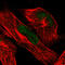 ATRX Chromatin Remodeler antibody, AMAb90784, Atlas Antibodies, Immunofluorescence image 