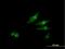 SCY1 Like Pseudokinase 3 antibody, H00057147-B01P, Novus Biologicals, Immunocytochemistry image 
