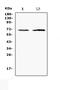 Caseinolytic Mitochondrial Matrix Peptidase Chaperone Subunit antibody, A00978-1, Boster Biological Technology, Western Blot image 