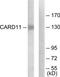 Caspase recruitment domain-containing protein 11 antibody, TA326290, Origene, Western Blot image 