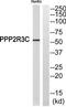 Protein Phosphatase 2 Regulatory Subunit B''Gamma antibody, TA315558, Origene, Western Blot image 