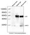 Neuronal Vesicle Trafficking Associated 1 antibody, LS-B14123, Lifespan Biosciences, Immunoprecipitation image 