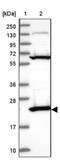 ATP Synthase Peripheral Stalk Subunit D antibody, NBP2-47545, Novus Biologicals, Western Blot image 