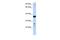 Visual System Homeobox 1 antibody, PA5-41142, Invitrogen Antibodies, Western Blot image 