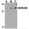 DNA Damage Regulated Autophagy Modulator 1 antibody, TA306391, Origene, Western Blot image 