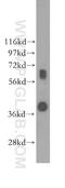 Sprouty RTK Signaling Antagonist 2 antibody, 11383-1-AP, Proteintech Group, Western Blot image 