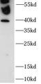 Zinc Finger Protein 140 antibody, FNab10746, FineTest, Western Blot image 