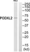 Podocalyxin Like 2 antibody, TA312712, Origene, Western Blot image 