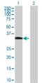 Homeobox protein Hox-C8 antibody, H00003224-D01P, Novus Biologicals, Western Blot image 