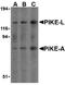 Arf-GAP with GTPase, ANK repeat and PH domain-containing protein 2 antibody, orb74548, Biorbyt, Western Blot image 