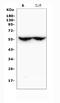 Cytochrome P450 Family 2 Subfamily C Member 19 antibody, A02102-2, Boster Biological Technology, Western Blot image 