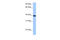 LOC641765 antibody, 30-701, ProSci, Enzyme Linked Immunosorbent Assay image 