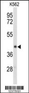 Ectonucleoside Triphosphate Diphosphohydrolase 2 antibody, 63-897, ProSci, Western Blot image 