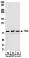 Phosphofructokinase, Liver Type antibody, NBP2-32212, Novus Biologicals, Western Blot image 