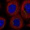 Dymeclin antibody, NBP2-55368, Novus Biologicals, Immunofluorescence image 