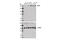 DNA Topoisomerase II Binding Protein 1 antibody, 14342S, Cell Signaling Technology, Western Blot image 