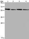 Ecto-ADP-ribosyltransferase 4 antibody, PA5-50607, Invitrogen Antibodies, Western Blot image 