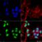 Choline acetyltransferase antibody, LS-C775460, Lifespan Biosciences, Immunocytochemistry image 