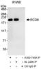 Enhancer of mRNA-decapping protein 4 antibody, A300-746A, Bethyl Labs, Immunoprecipitation image 