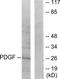Platelet Derived Growth Factor Subunit B antibody, TA314326, Origene, Western Blot image 