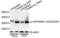 Ribosomal Protein S6 antibody, STJ113488, St John