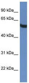 TBC1 Domain Family Member 10A antibody, TA342994, Origene, Western Blot image 