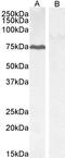 Protein Phosphatase 1 Regulatory Subunit 15A antibody, TA302708, Origene, Western Blot image 