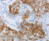 P2Y purinoceptor 4 antibody, A3059, ABclonal Technology, Immunohistochemistry paraffin image 