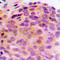 BCL2 Associated Athanogene 4 antibody, LS-C353184, Lifespan Biosciences, Immunohistochemistry paraffin image 